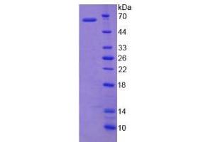 Image no. 1 for UDP-Gal:betaGlcNAc beta 1,3-Galactosyltransferase, Polypeptide 5 (B3GALT5) (AA 29-310) protein (His tag,GST tag) (ABIN6238337) (B3GALT5 Protein (AA 29-310) (His tag,GST tag))