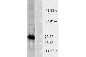 Western blot analysis of Human Cell line lysates showing detection of SOD1 protein using Rabbit Anti-SOD1 Polyclonal Antibody . (SOD1 Antikörper  (FITC))