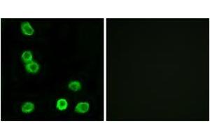 Immunofluorescence analysis of MCF7 cells, using GPR63 Antibody.
