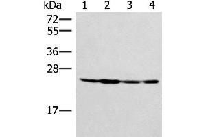 Western blot analysis of Hela 231 and A549 cell Mouse liver tissue lysates using SSSCA1 Polyclonal Antibody at dilution of 1:400