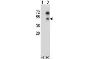 Western blot analysis of GNAS (arrow) using GNAS Antibody (C-term) Cat. (GNAS Antikörper  (C-Term))