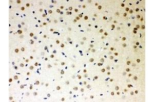 IHC-P: PKC iota antibody testing of rat brain tissue (PKC iota Antikörper  (AA 21-214))