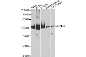 Western blot analysis of extracts of various cell lines, using MCM5 antibody. (MCM5 Antikörper  (AA 1-230))