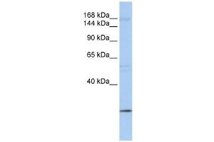 UBR2 antibody used at 1 ug/ml to detect target protein. (UBR2 Antikörper  (C-Term))