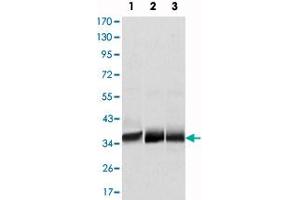 Western blot analysis using MSI2 monoclonal antibody, clone 2C11  against NTERA-2 (1), SW620 (2) and T-47D (3) cell lysate.
