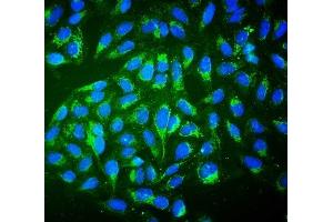IF analysis of ALDH2 using anti-ALDH2 antibody (ABIN7603122). (ALDH2 Antikörper  (N-Term))