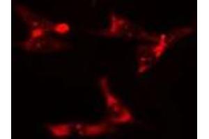 ABIN6275900 staining  HuvEc cells by IF/ICC. (TOLLIP Antikörper  (Internal Region))