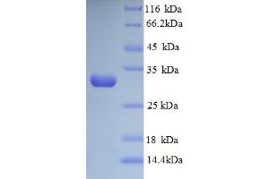 SDS-PAGE (SDS) image for Protein-Lysine 6-Oxidase (LYOX) (AA 174-417), (partial) protein (His tag) (ABIN5713060)