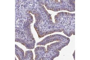 Immunohistochemical staining of human fallopian tube with B9D2 polyclonal antibody  shows distinct positivity in ciliated cells. (B9D2 Antikörper)