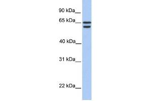 WB Suggested Anti-CDYL2 Antibody Titration:  0. (CDYL2 Antikörper  (N-Term))