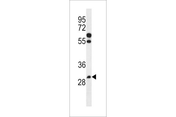 PGAP3 Antikörper  (AA 141-169)