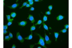 IF analysis of LARP1 using anti-LARP1 antibody (ABIN7599861). (LARP1 Antikörper  (AA 123-401))