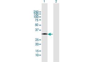 Western Blot analysis of ZCRB1 expression in transfected 293T cell line by ZCRB1 MaxPab polyclonal antibody. (ZCRB1 Antikörper  (AA 1-217))