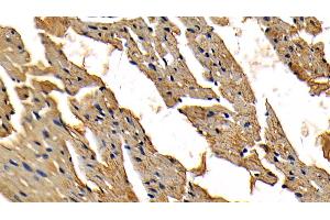 Immunohistochemistry (IHC) image for anti-Interleukin-1 Receptor-Associated Kinase 4 (IRAK4) (AA 189-427) antibody (ABIN7433738)