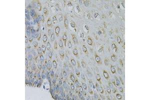 Immunohistochemistry of paraffin-embedded human esophagus using EIF4B Antibody. (EIF4B Antikörper)