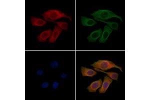 ABIN6262495 and ABIN6277945 staining Hela cells by IF/ICC. (IGFBP2 Antikörper  (C-Term))