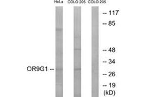 Western blot analysis of extracts from HeLa/COLO cells, using OR9G1 Antibody. (OR9G1 Antikörper  (AA 158-207))