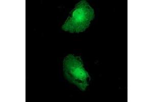 Anti-FKBPL mouse monoclonal antibody (ABIN2453045) immunofluorescent staining of COS7 cells transiently transfected by pCMV6-ENTRY FKBPL (RC202153). (FKBPL Antikörper)
