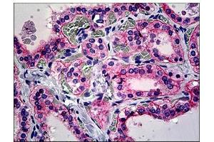 Human Thyroid: Formalin-Fixed, Paraffin-Embedded (FFPE) (CD51 Antikörper  (C-Term))