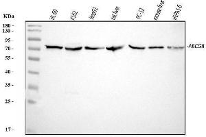Western blot analysis of ABCG8 using anti-ABCG8 antibody (ABIN5518720).