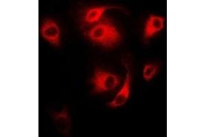 Immunofluorescent analysis of CD27 staining in MCF7 cells.