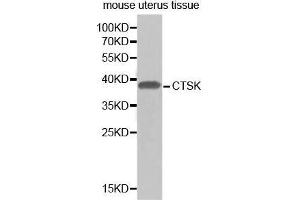 Western Blotting (WB) image for anti-Cathepsin K (CTSK) (AA 115-329) antibody (ABIN3022539) (Cathepsin K Antikörper  (AA 115-329))