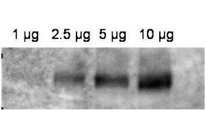 Western blot using  affinity purified anti-ABCB1 antibody shows detection of ABCB1 in crude membrane extracts from HF insect cells over-expressing human ABCB1. (ABCB1 Antikörper  (Internal Region))