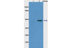 Lane 1: mouse embryo lysates Lane 2: mouse brain lysates probed with Anti Phospho-Smad3(Ser423/425) Polyclonal Antibody, Unconjugated (ABIN746138) at 1:200 in 4 °C. (SMAD3 Antikörper  (pSer423, pSer425))