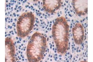 DAB staining on IHC-P; Samples: Human Stomach Tissue (ADH1 Antikörper  (AA 169-370))