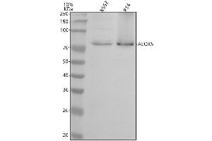 Western blot analysis of ALOX5 using anti-ALOX5 antibody (ABIN7603850).
