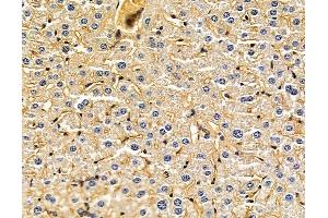 ABIN7095956 and ABIN7100018 at 1/100 staining mouse liver tissue by IHC-P. (PLA2G3 Antikörper)