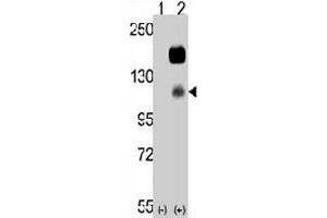 Western blot analysis of CCK4 (arrow) using rabbit PTK7 polyclonal antibody . (PTK7 Antikörper  (N-Term))