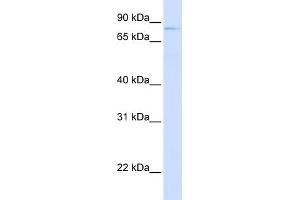WB Suggested Anti-OLFML2B Antibody Titration:  0. (OLFML2B Antikörper  (N-Term))