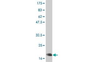 Western Blot detection against Immunogen (21 KDa) . (IL-6 Antikörper  (AA 29-212))