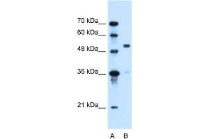 WB Suggested Anti-SLC37A3 Antibody Titration:  0. (SLC37A3 Antikörper  (Middle Region))
