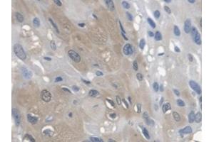 Detection of ARSA in Human Esophagus Tissue using Polyclonal Antibody to Arylsulfatase A (ARSA) (Arylsulfatase A Antikörper)