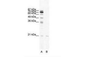 Image no. 1 for anti-SCAN Domain Containing 1 (SCAND1) (AA 65-114) antibody (ABIN6736033) (SCAND1 Antikörper  (AA 65-114))