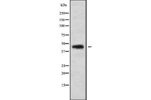 Western blot analysis of CCBE1 using HUVEC whole cell lysates (CCBE1 Antikörper  (Internal Region))