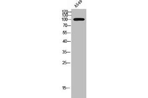 Western Blot analysis of A549 cells using Rhophilin Polyclonal Antibody (RHPN1 Antikörper  (Internal Region))