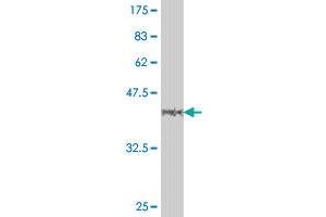 Western Blot detection against Immunogen (38. (MLL/KMT2A Antikörper  (AA 3561-3670))