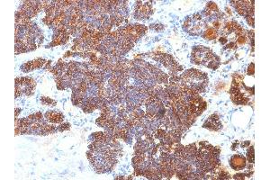 Formalin-fixed, paraffin-embedded human Parathyroid stained with PTH Mouse Monoclonal Antibody (PTH/1173). (PTH Antikörper  (AA 32-115))