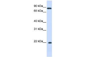 IFN Alpha 7 antibody used at 1 ug/ml to detect target protein. (IFNA7 Antikörper  (N-Term))
