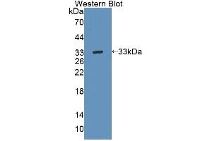 Figure. (Tec Protein Tyrosine Kinase (TEC) (AA 370-623) Antikörper)
