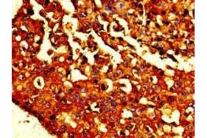 Immunohistochemistry (IHC) image for anti-Cadherin 1, Type 1, E-Cadherin (Epithelial) (CDH1) (AA 153-641) antibody (ABIN7146190)
