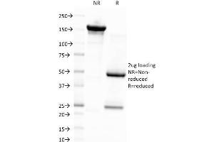SDS-PAGE Analysis Purified EBV Mouse Monoclonal Antibody (CS4). (EBV LMP1 Antikörper)