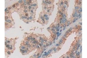 Immunohistochemistry (IHC) image for anti-Pigeon Homolog (PION) (AA 616-854) antibody (ABIN7439789)
