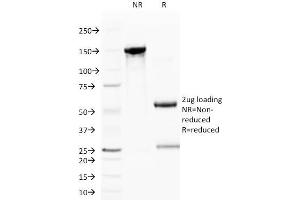 SDS-PAGE Analysis Purified CD59 Mouse Monoclonal Antibody (BRA-10G). (CD59 Antikörper)