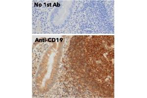 Immunohistochemistry (IHC) image for anti-CD19 Molecule (CD19) (C-Term) antibody (ABIN6254219)