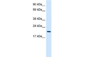 WB Suggested Anti-MYCL1 Antibody Titration:  2. (LMYC Antikörper  (Middle Region))