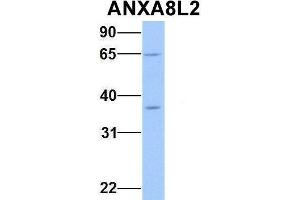 Host:  Rabbit  Target Name:  ANXA8L2  Sample Type:  Human Fetal Heart  Antibody Dilution:  1. (ANXA8L2 Antikörper  (Middle Region))